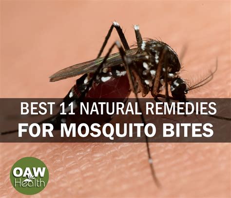 Best 11 Natural Remedies For Mosquito Bites Oawhealth