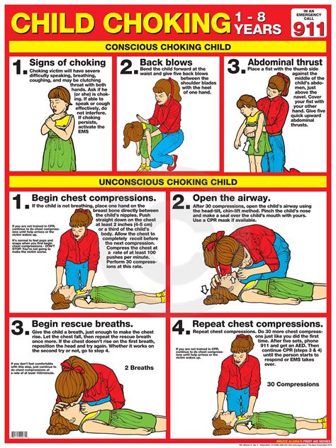 First Aid Choking Child | Child choking, Child cpr 