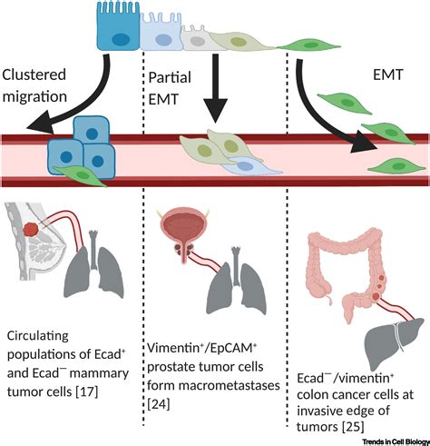 Emt Met Plasticity And Tumor Metastasis Trends In Cell Biology