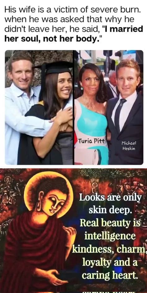 Eugene Chung On Twitter Turia Pitt And Michael Hoskin Love Story In Pictures Woman S Day