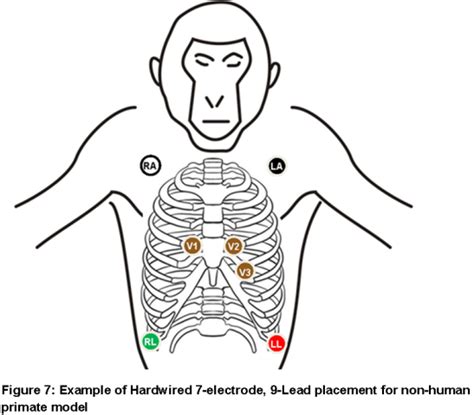 Diagram Ecg Lead Placement Guide Diagram Mydiagramonline