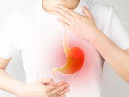 Peptic Ulcer Disease Causes Symptoms Treatment And Preventions