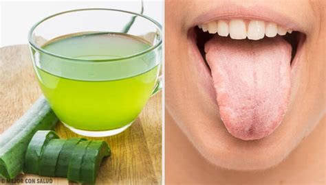 7 Natural Remedies For A White Tongue Step To Health