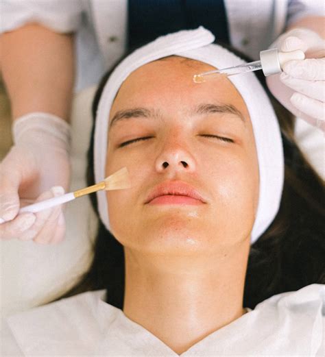 Chemical Peels The Beauty Spot Cosmetic Clinic