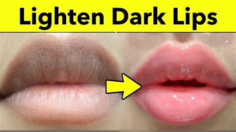 how to lighten dark lips naturally 4 rapid home remedies dark lips treatment at home youtube