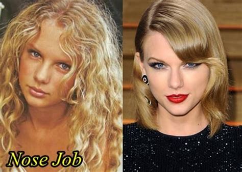 Taylor Swift Plastic Surgery Nose Job Celebrity Plastic Surgery