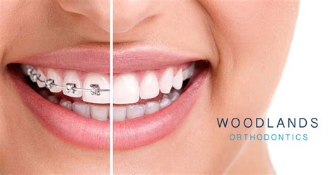 Woodlands Orthodontics Bray And Greystones Specialist Orthodontist
