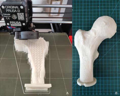 Printing Process And Finally 3d Printed Bone Example Femur1 A