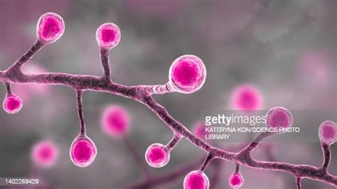 Blastomycosis Photos And Premium High Res Pictures Getty Images