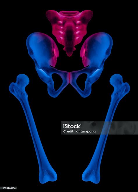 X Ray Of Separate Human Hip And Femur Bone Anterior View Red Highlight