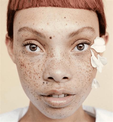 10 Photos Of People With Extraordinarily Unusual Features That Will Have You Redefining Beauty