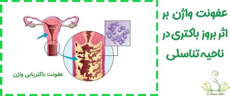 عفونت واژن درمان و علائم عفونت واژن انواع عفونت واژن دکتر ماندانا اکبری