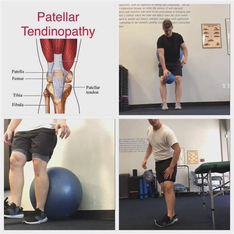 Patellar Tendinopathy Movement Fitness Leg And Glute Workout Knee
