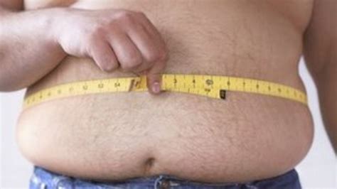 Obese Patients Asked To Lose Weight Before Surgery Bbc News
