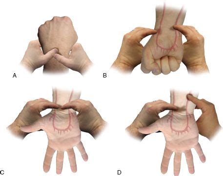 Developer, allentest2 is a tools app on the android platform. Management of the Partial Glossectomy Defect: Radial ...