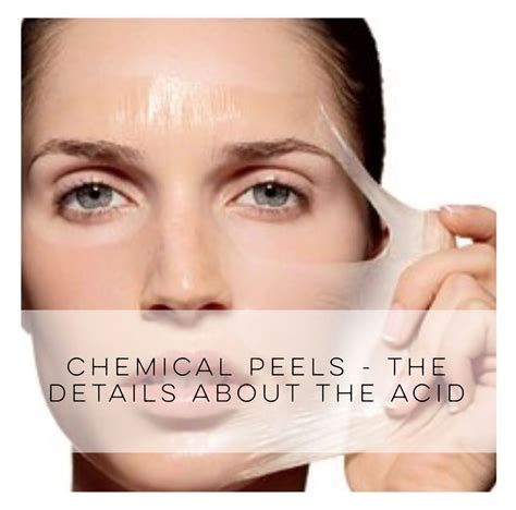 The Truth About Chemical Peels And What You Need To Know Before Going In Beauty Blogging From