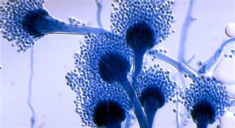 Aspergillus Microscope