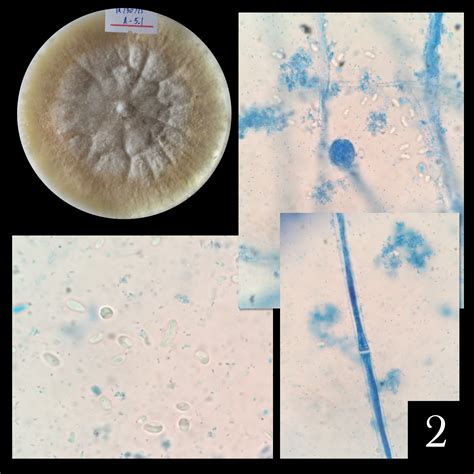 Pictures Attached Can Anyone Please Help Me Identify These Endophytic