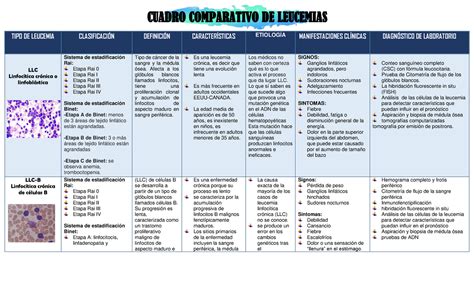 Cuadro Comparativo Leucemias Tipo De Leucemia Clasificacin Definici