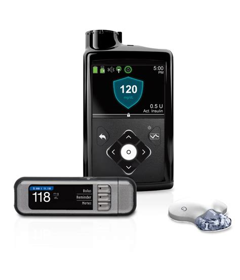 Continuous Glucose Monitoring Children With Diabetes