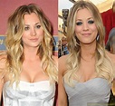 Kaley Cuoco Plastic Surgery Before And After