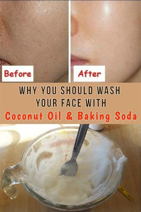 Baking Soda And Coconut Oil Face Mask For Acne Scars Cooky And Foody