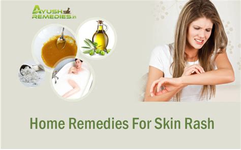 8 Best Home Remedies For Skin Rashes Herbal And Effective Treatment