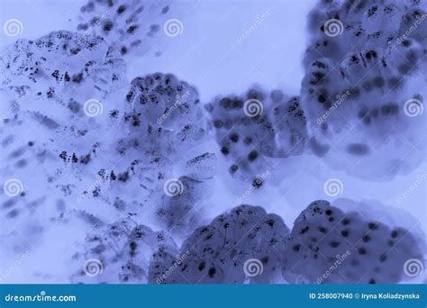 Microorganisms Under A Microscope Microbiology And Health Stock Photo