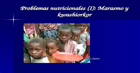 Ppt Problemas Nutricionales I Marasmo Y Kwashiorkor Mª José Vélez