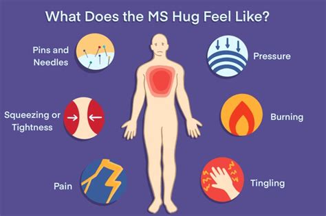 The Ms Hug Symptoms Triggers Treatments And Tips To Manage