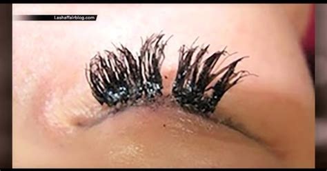 From Minor Itching To Serious Infections Experts Discuss Dangers Of Eyelash Extensions