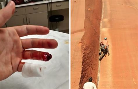 Climber Falls In Utah Losing Finger In Famous Crack Line The Inertia