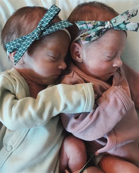 Birth Story Preemie Twins Born At 30 Weeks Nicu Palms To Pines