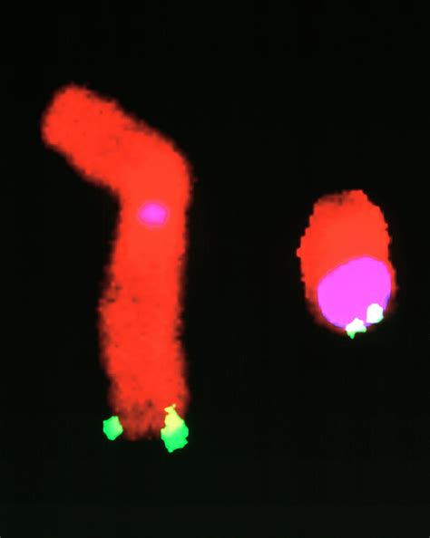 X And Y Human Sex Chromosomes Photograph By Dept Of Clinical