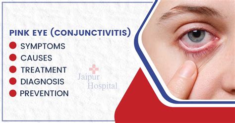 Pink Eye Conjunctivitis Symptoms Diagnosis Causes Treatment And