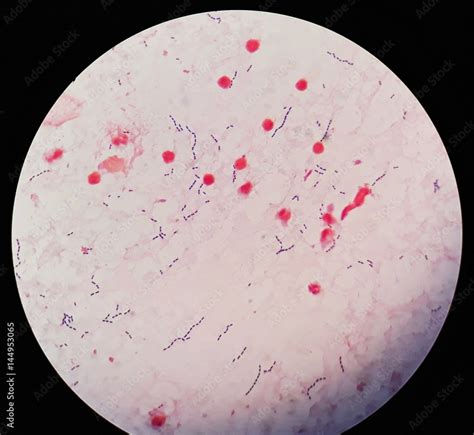 Smear Of Human Blood Culture Gram S Stained With Gram Positive Cocci In