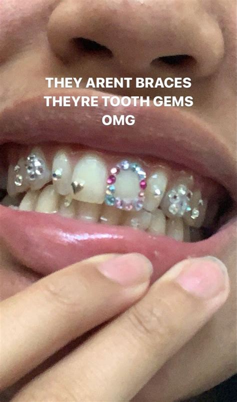 Pin By Ix Ine On Accessories Teeth Jewelry Tooth Gem Dental Jewelry