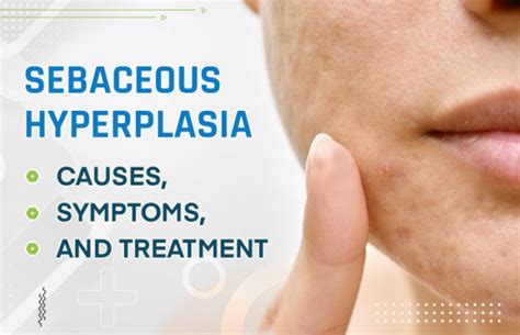 Sebaceous Hyperplasia Causes Symptoms And Treatment Call Now