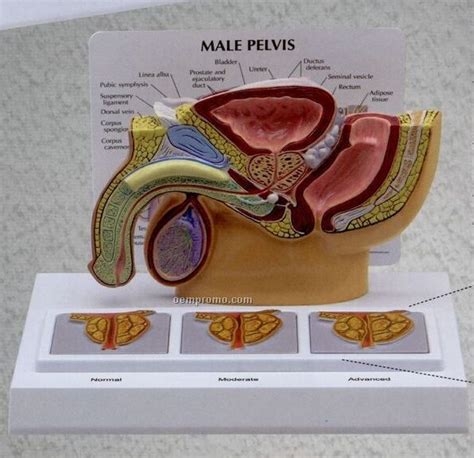 Anatomical Male Pelvis Model W 3d Prostate Frame China Wholesale Anatomical Male Pelvis Model W