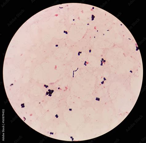 Foto Stock Smear Of Human Blood Cultured Gram S Stained With Gram