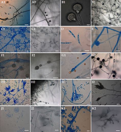 Microscopic Observations Of 21 Day Old Fungal Culture On Pda At 25 ± 1