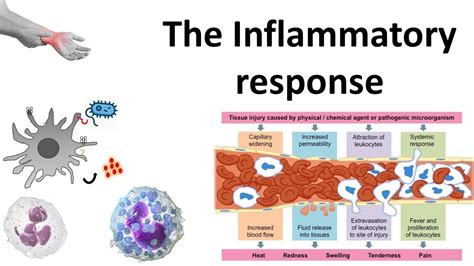 Inflammatory Response Process