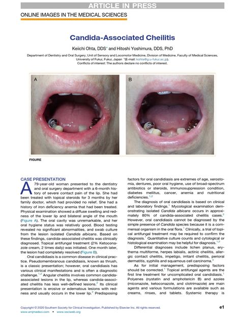 Candida Associated Cheilitis Online Images In The Medical Sciences