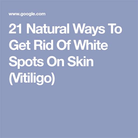 White Spots On Skin Vitiligo Causes Symptoms And Remedies