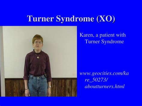 Xxy Syndrom