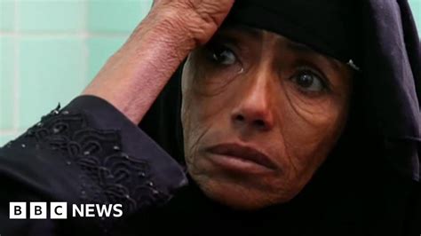 Yemen Could Be Worst Famine In 100 Years Bbc News