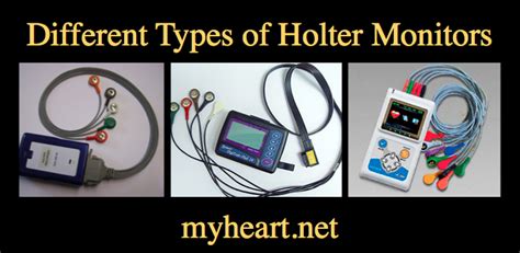 Holter Monitor Explained By A Cardiologist Myheart