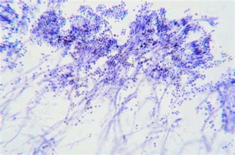 Penicillium Branches Ascomycetous Fungi Under The Microscope Stock