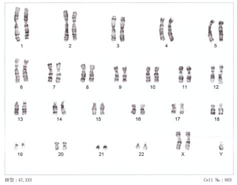 Chromosomes Polyploidy And Why Sex Evolved