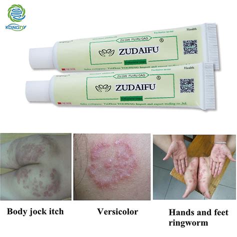 Psoriasis Cream Herbal Ointment Chinese Traditional Plaster 1pcs